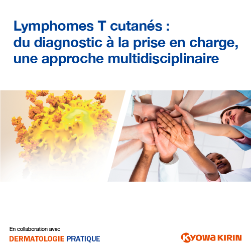 lymphomes