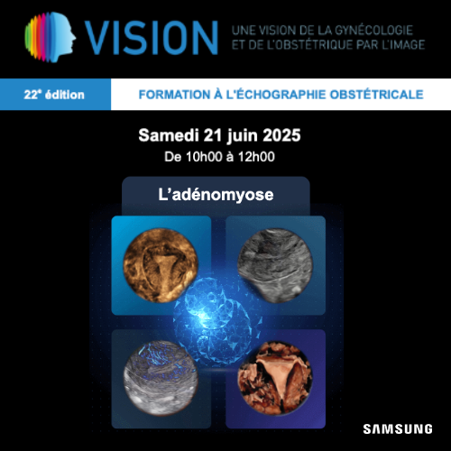 revuevision